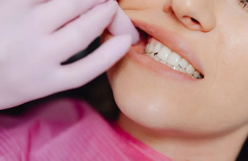Gentle tooth extraction procedure performed at Recreate Smiles Joondalup